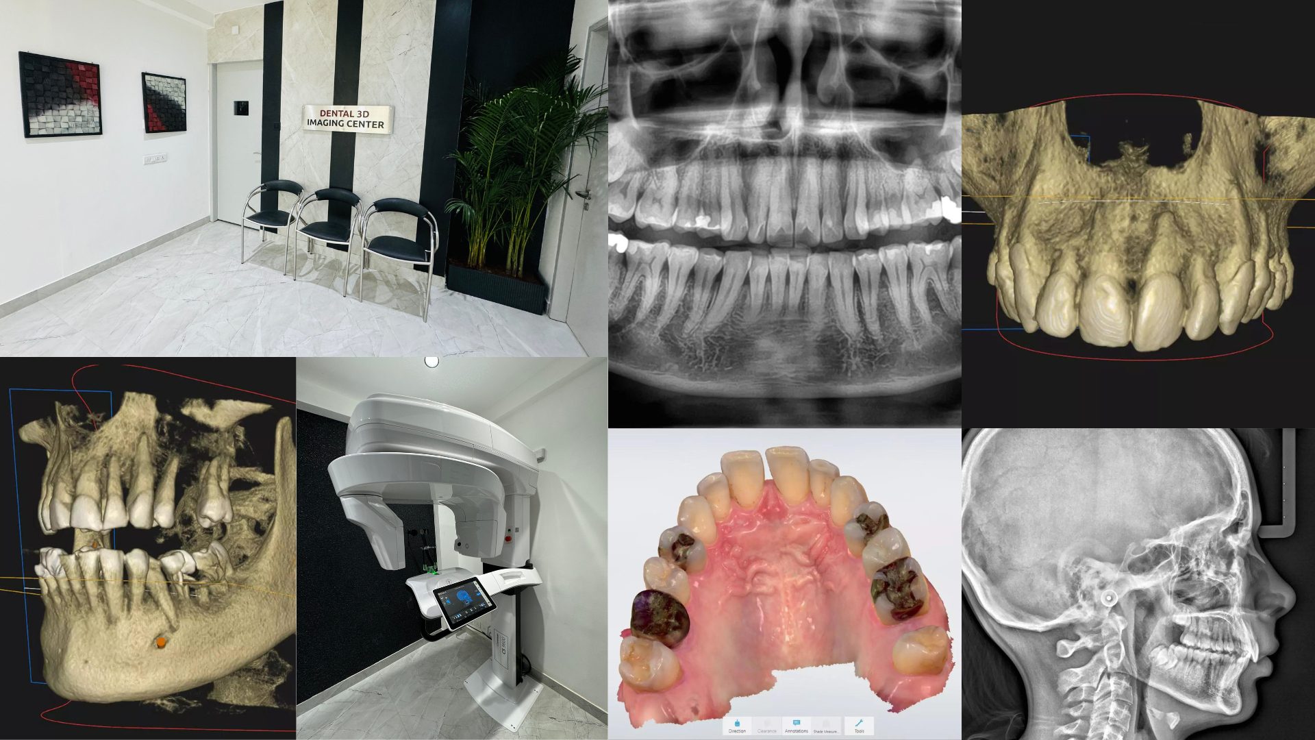 In-House Dental Imaging Center Collage