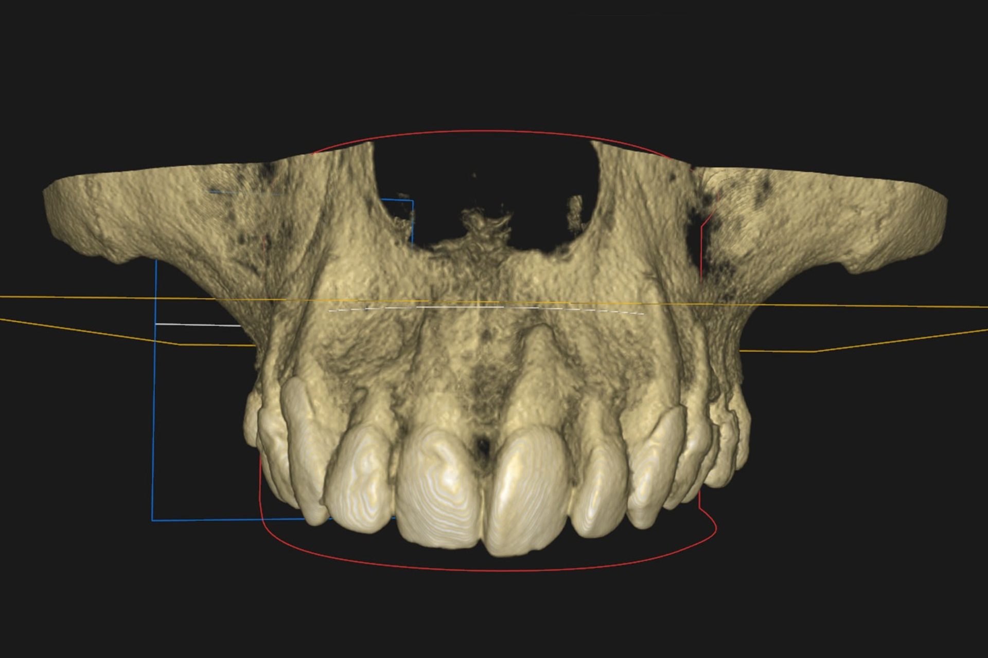 Advanced Imaging Advanced Imaging